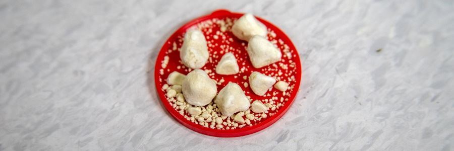 Nierensteine, die Symptome, Behandlung und Vorbeugung